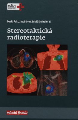 Stereotaktická radioterapie /