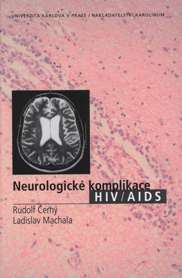 Neurologické komplikace HIV/AIDS /