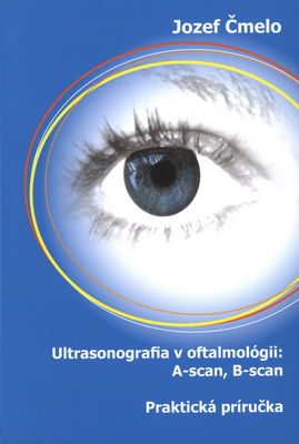 Ultrasonografia v oftalmológii: A-scan, B-scan : praktická príručka /