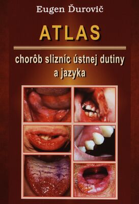 Atlas chorôb slizníc ústnej dutiny a jazyka /
