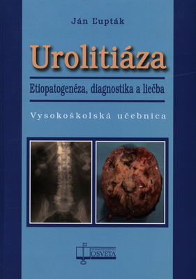 Urolitiáza : etiopatogenéza, diagnostika a liečba /