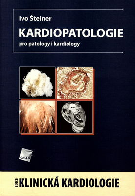 Kardiopatologie pro patology i kardiology /
