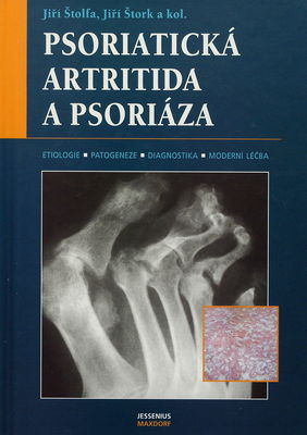 Psoriatická artritida a psoriáza : [etiologie, patogeneze, diagnostika, moderní léčba] /