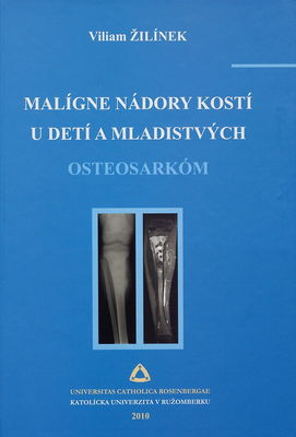 Malígne nádory kostí u detí a mladistvých : osteosarkóm : monografia /