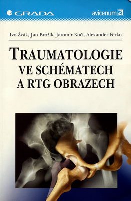 Traumatologie ve schématech a RTG obrazech /