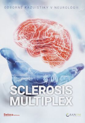 Sclerosis multiplex : odborné kazuistiky v neurológii.