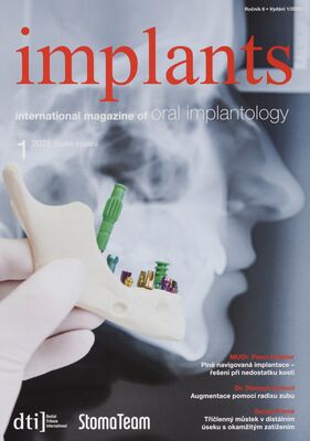 Implants : international magazine of oral implantology ; české vydání.