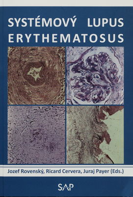 Systémový lupus erythematosus /