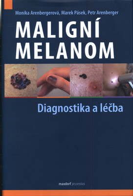 Maligní melanom : diagnostika a léčba na základě aktuálního doporučeného postupu /
