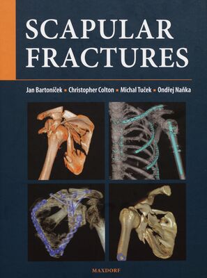 Scapular fractures /