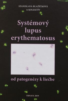 Systémový lupus erythematosus - od patogenézy k liečbe /