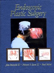Endoscopic plastic surgery. /
