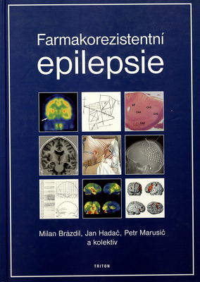 Farmakorezistentní epilepsie /