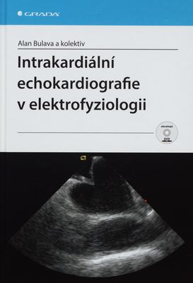 Intrakardiální echokardiografie v elektrofyziologii /