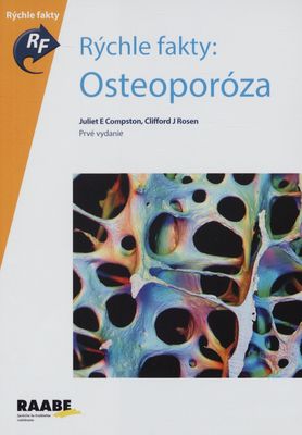 Rýchle fakty: Osteoporóza /