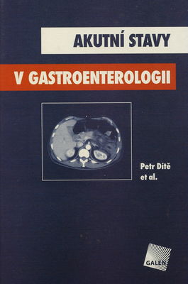 Akutní stavy v gastroenterologii /