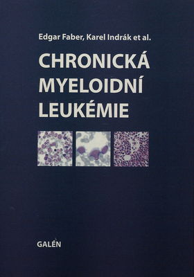 Chronická myeloidní leukémie /