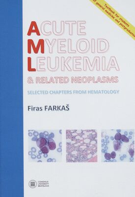 Acute myeloid leukemia & related neoplasms : selected chapters from hematology /