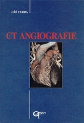 CT angiografie /