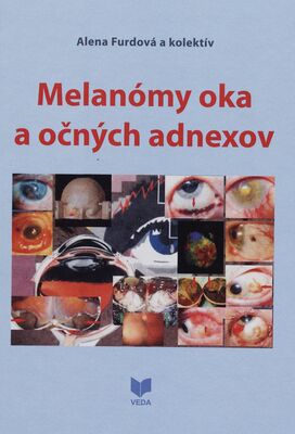 Melanómy oka a očných adnexov /