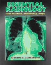 Essential radiology. : Clinical presentation. Pathophysiology. Imaging. /
