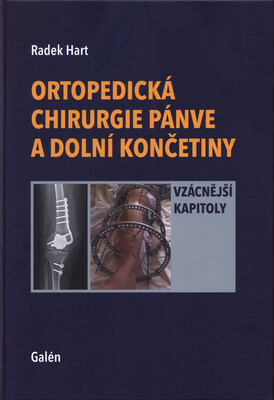Ortopedická chirurgie pánve a dolní končetiny : vzácnější kapitoly /