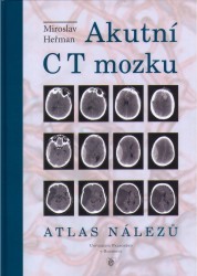 Akutní CT mozku : atlas nálezů /