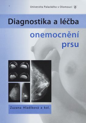 Diagnostika a léčba onemocnění prsu /