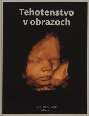 Tehotenstvo v obrazoch : prehľadné informácie s jedinečným obrazovým materiálom /
