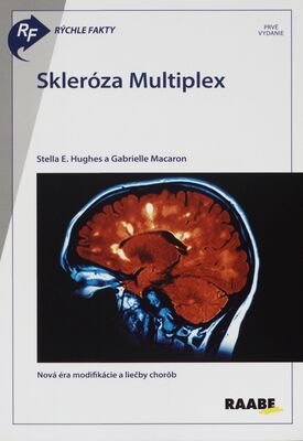 Rýchle fakty: Skleróza multiplex /