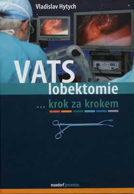 VATS lobektomie krok za krokem /