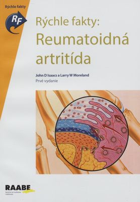 Rýchle fakty: reumatoidná artritída /