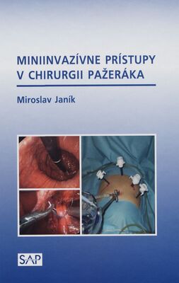 Miniinvazívne prístupy v chirurgii pažeráka /