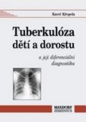 Tuberkulóza dětí a dorostu a její diferenciální diagnostika. /