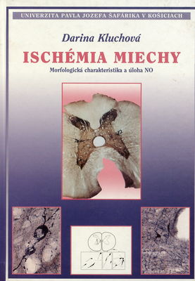 Ischémia miechy : morfologická charakteristika a úloha NO /