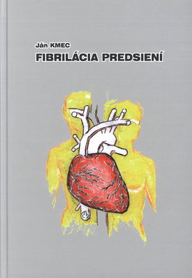 Fibrilácia predsiení /