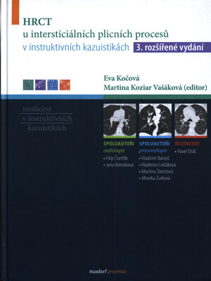 HRCT u intersticiálních plicních procesů v instruktivních kazuistikách /