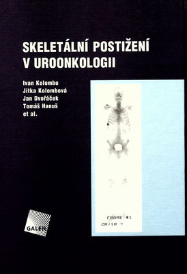 Skeletální postižení v uroonkologii /
