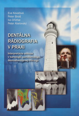Dentálna rádiografia v praxi : interpretácia snímok v kariológii, parodontológii, dentoalveolárnej chirurgii /