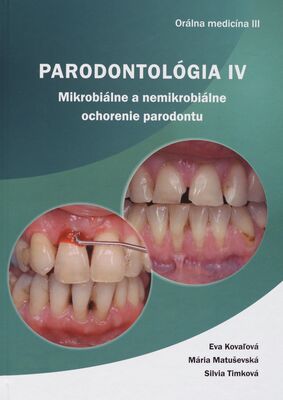 Parodontológia IV. Mikrobiálne a nemikrobiálne ochorenie paradontu /