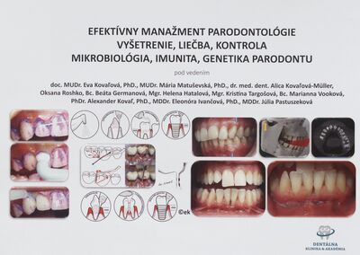 Efektívny manažment parodontológie vyšetrenie, liečba, kontrola, mikrobiológia, imunita, genetika parodontu /