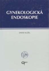 Gynekologická endoskopie. /