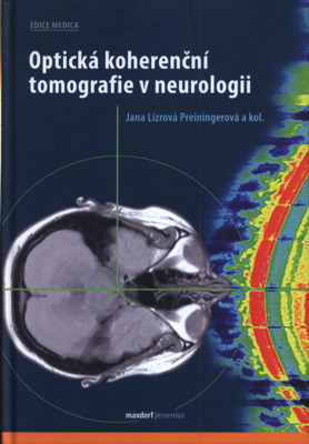 Optická koherenční tomografie v neurologii /