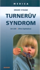 Turnerův syndrom /