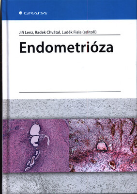 Endometrióza /
