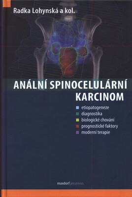 Anální spinocelulární karcinom /