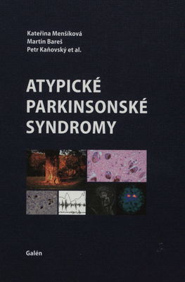 Atypické parkinsonské syndromy /