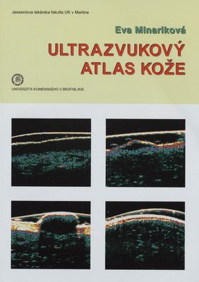 Ultrazvukový atlas kože /