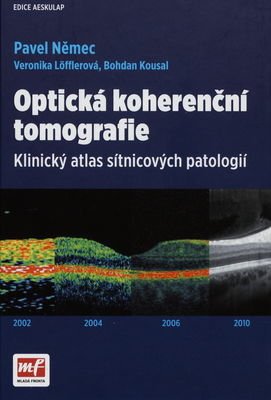 Optická koherenční tomografie : klinický atlas sítnicových patologií /