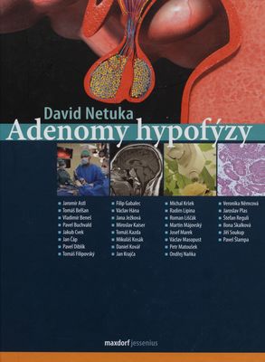 Adenomy hypofýzy : diagnostika a komplexní léčba /